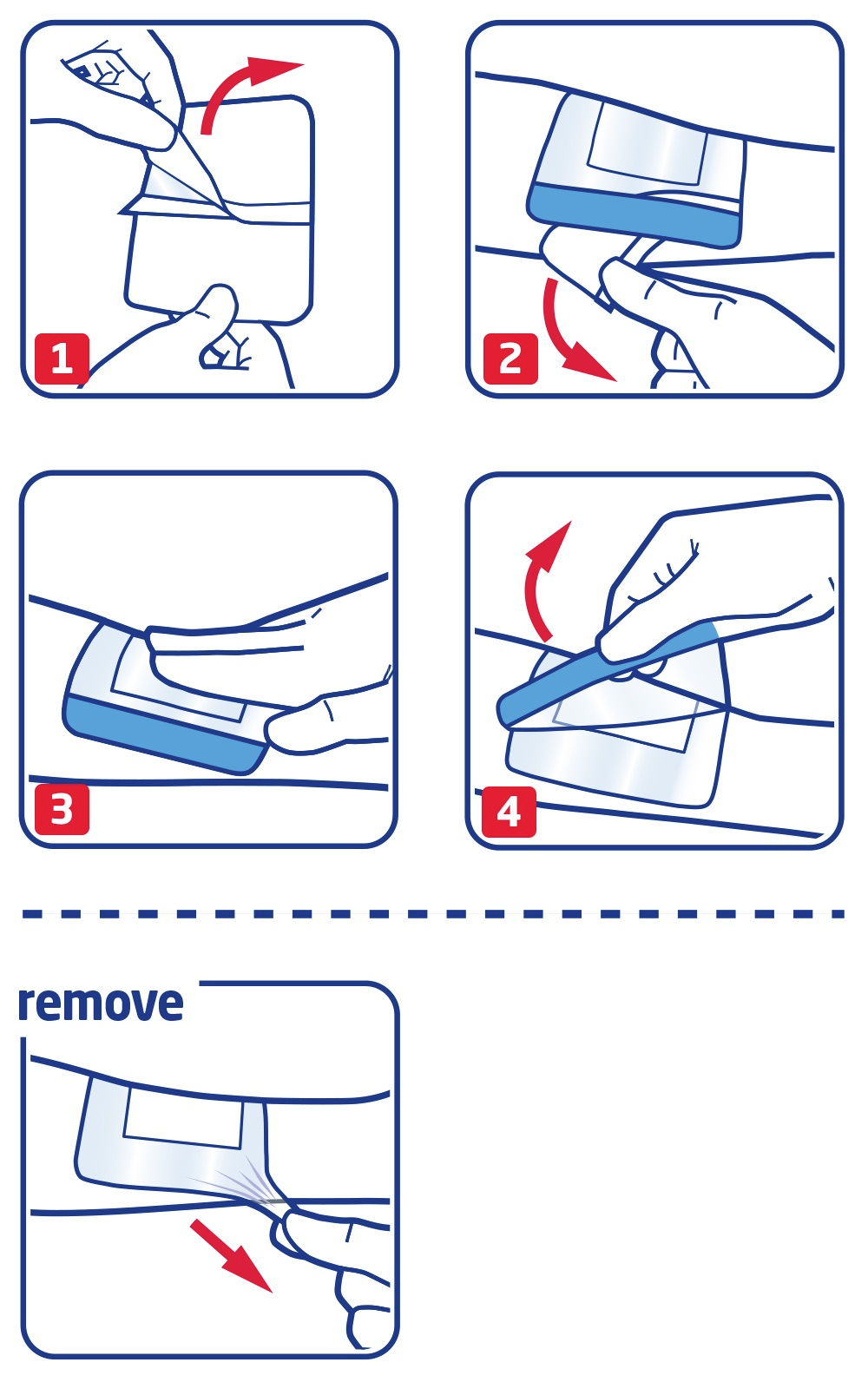 How to use Leukomed Sorbact by Leukoplast How to use Leukomed Sorbact by Leukoplast